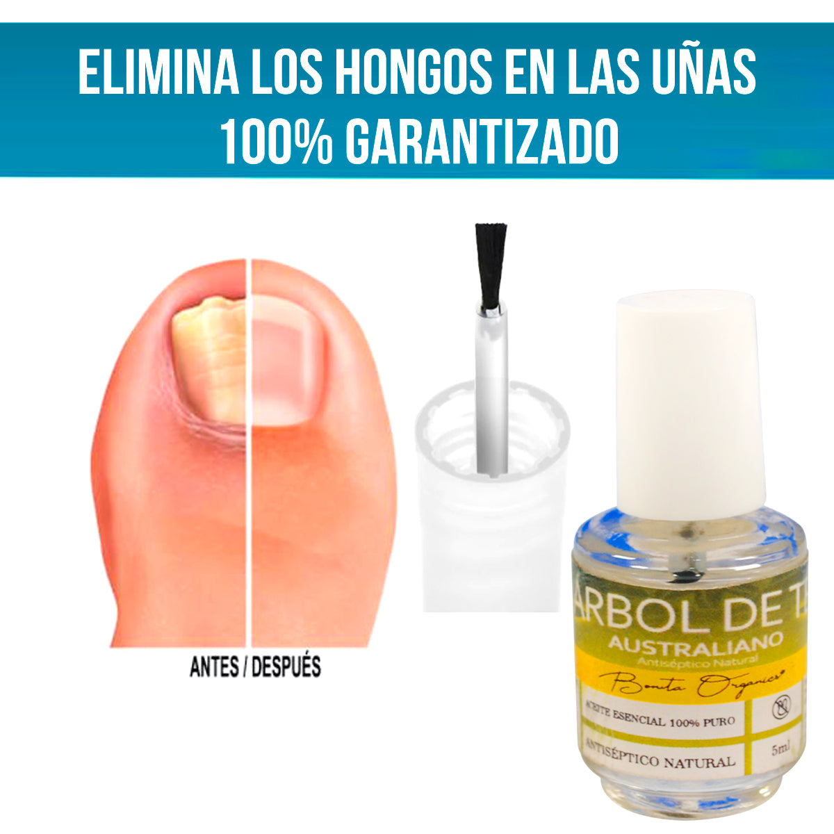 tratamiento para hongos arbol de te 100 %  puro