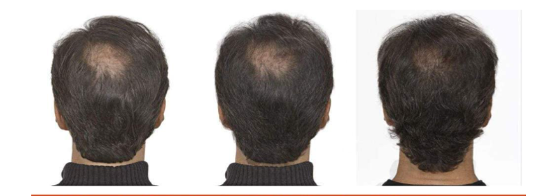 loción para crecimiento de cabello y barba 100 ml