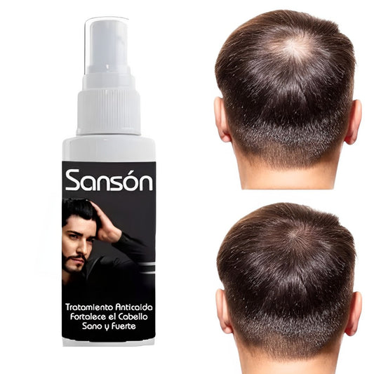 Loción Para Crecimiento De Cabello Y Barba 100 ML